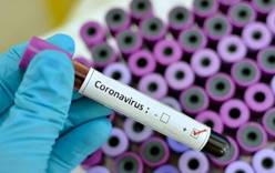 Еще пять человек заболели коронавирусом во Франции