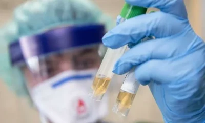 Названа новая причина высокой смертности в Италии от коронавируса