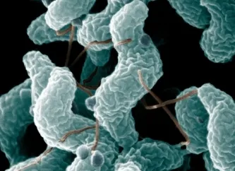 Десятки российских туристов отравились в Греции