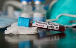 В России зафиксирована первая смерть от коронавируса