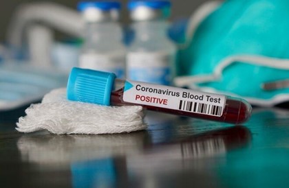 В России зафиксирована первая смерть от коронавируса