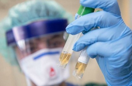 Названа новая причина высокой смертности в Италии от коронавируса