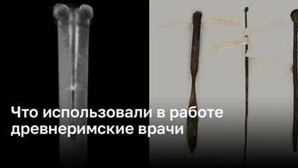 Медицинские инструменты, используемые древними римскими врачами